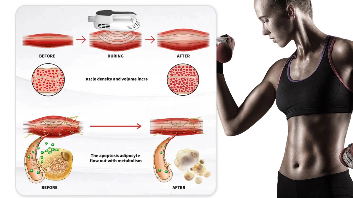 slim beauty machine emsculpt slim beauty machine emsculpt